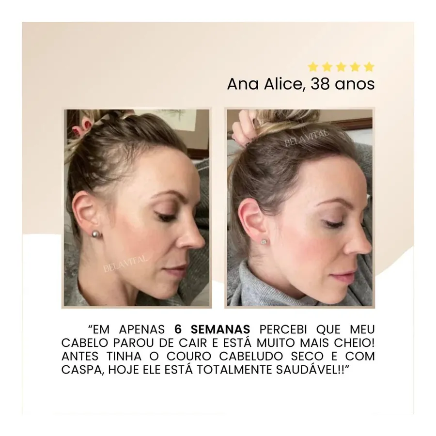 Bela Vital Repair Hair Therapy: Tratamento Antiquedas 3 em 1 — foto 3