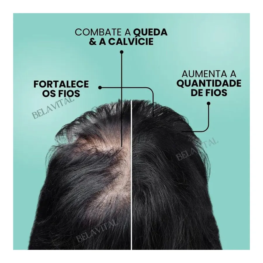 Bela Vital Repair Hair®: 95% Menos Queda 20x Mais Crescimento - Compre 1, Leve 2 — foto 3