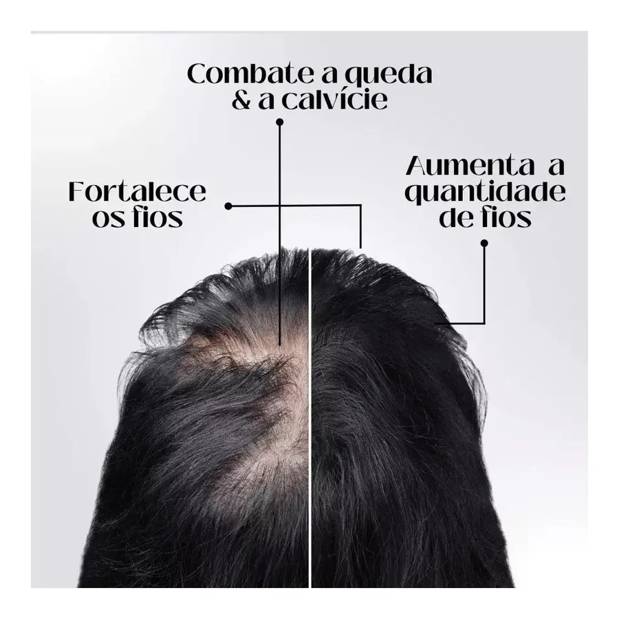 Bela Vital Repair Hair® - Crescimento Capilar e Combate à Queda de Cabelo — foto 3