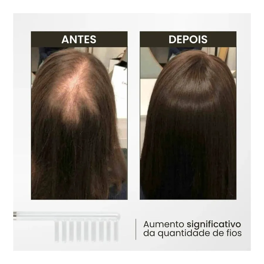Bela Vital Escova de Alta Frequência: Inovação para Revitalização Capilar — foto 3