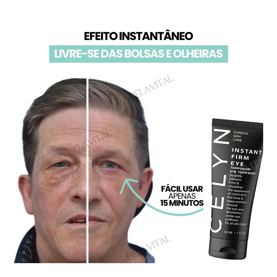 Bela Vital Celyn: Creme para Olheiras e Rejuvenescimento dos Olhos Avançado — foto 3